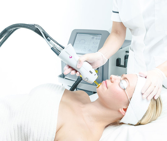 Laser hair removal treatment