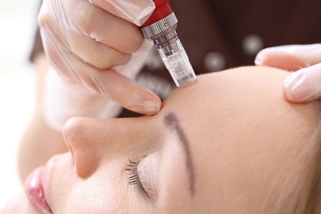 Medical microneedling collagen induction therapy